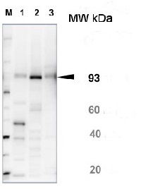 SUS1 | Sucrose synthase 1 in the group Antibodies Plant/Algal / Carbohydrates at Agrisera AB (Antibodies for research) (AS15 2830)